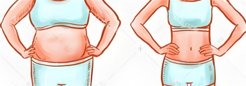 激光溶脂瘦腰术前后对比