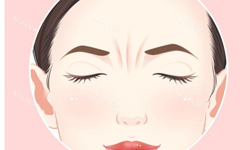 额头川字纹怎么消除比较好？这些日常护理/医美消除方法超实用，快收藏！
