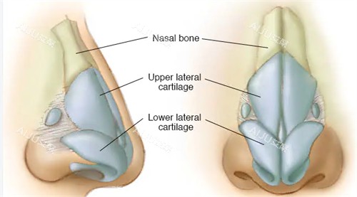 隆鼻手术动画图示 隆鼻手术动画图示