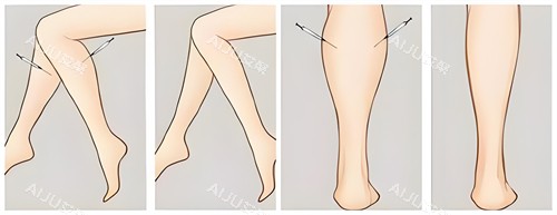 腿部吸脂手术前后对比动画图