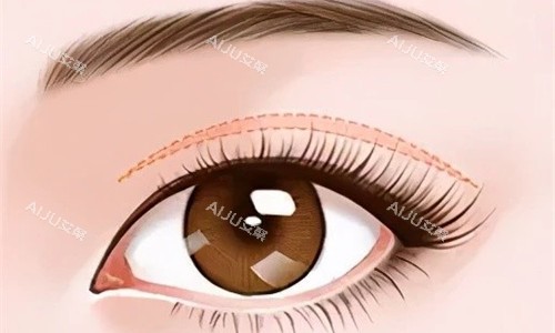 怎么能联系到孟明星医生?官网/电话/公众号等多方式预约医生,找他做双眼皮人太多需提前预约比较好 怎么能联系到孟明星医生?官网/电话/公众号等多方式预约医生,找他做双眼皮人太多需提前预约比较好