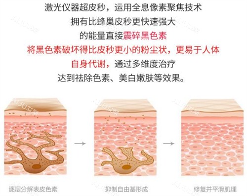 激光祛斑前后的对比