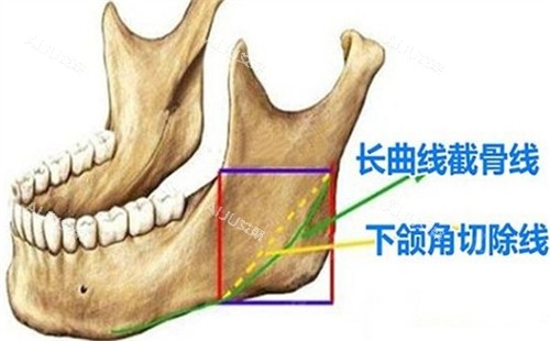 重庆华美紫馨下颌角所在位置