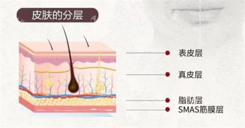 softwave索夫波适用皮肤层次