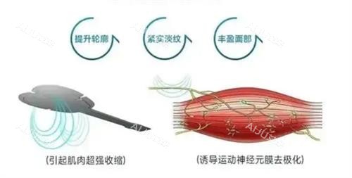 emface 美菲斯功效