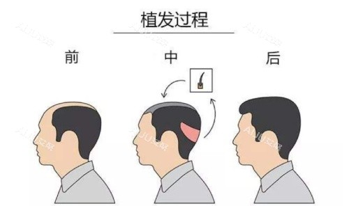 头顶加密过程示意图