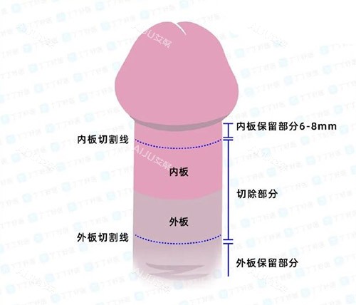 男性阴茎照片