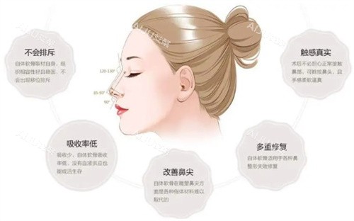 段焘医生软骨隆鼻的优势
