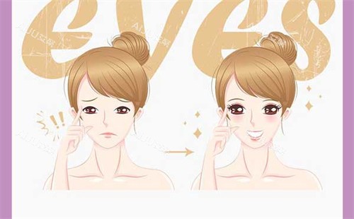 遵义美若瑶光双眼皮手术前后对比图