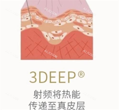 以色列3Deep相控射频作用