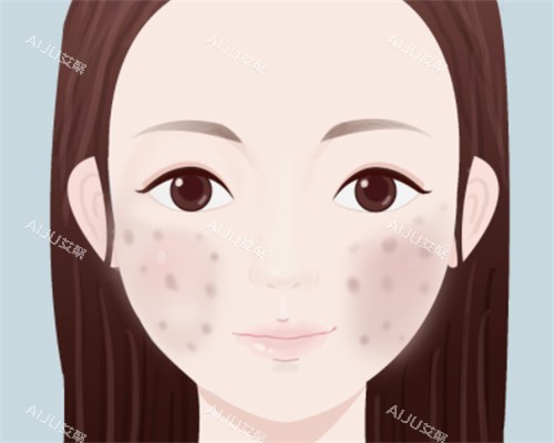 脸上痘印怎么办