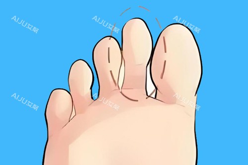 苏敬达二脚趾长卡通图