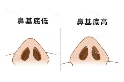 鼻基底展示图