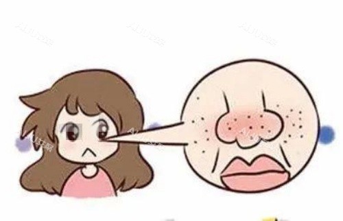 鼻子部位毛孔粗大示意图