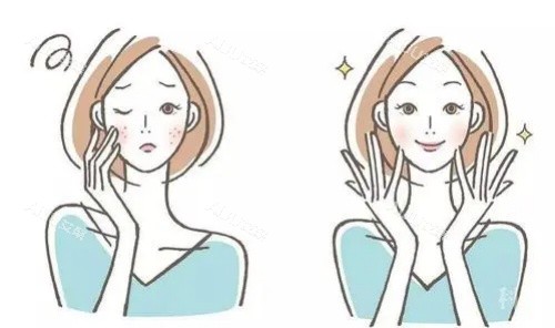 毛孔粗大医美前后对比图