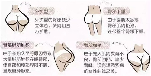 不***的臀型
