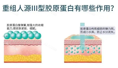 重组三型胶原蛋白有哪些作用 重组三型胶原蛋白有哪些作用