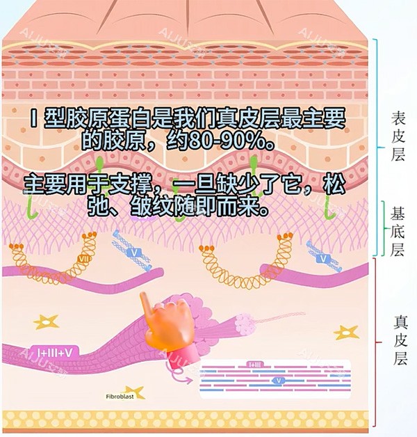 一型胶原蛋白和三型对比 一型胶原蛋白和三型对比