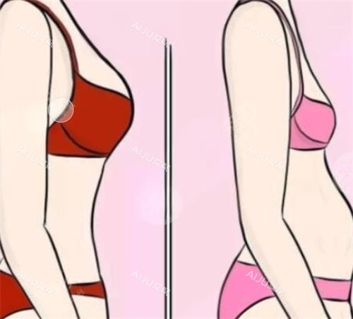 隆胸前后成效对比图 隆胸前后成效对比图