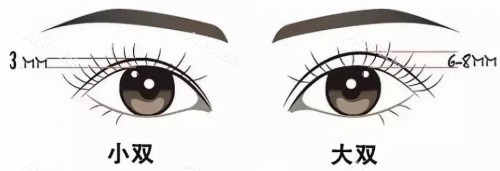 双眼皮宽度示意图 双眼皮宽度示意图