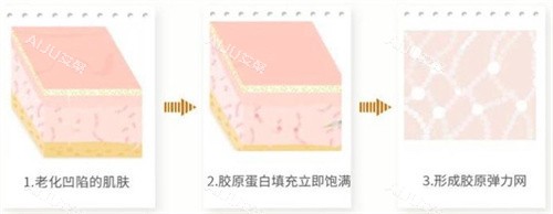 胶原蛋白工作原理 胶原蛋白工作原理