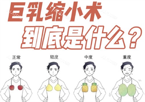 巨乳缩小术是什么 巨乳缩小术是什么