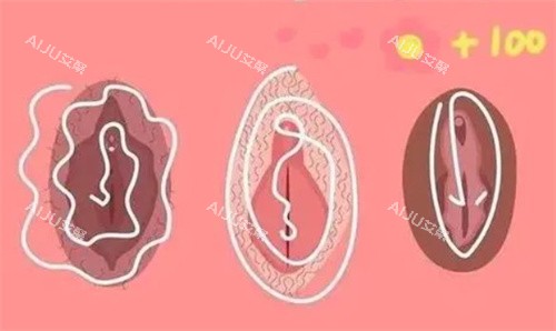 私密漂红卡通图 私密漂红卡通图