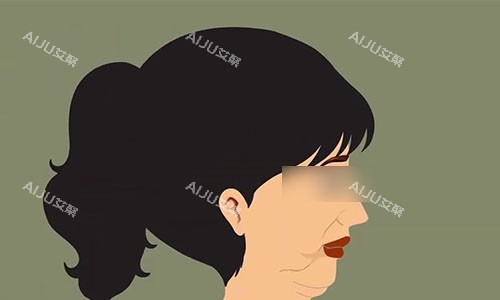 拉皮手术前的动画示意图 拉皮手术前的动画示意图