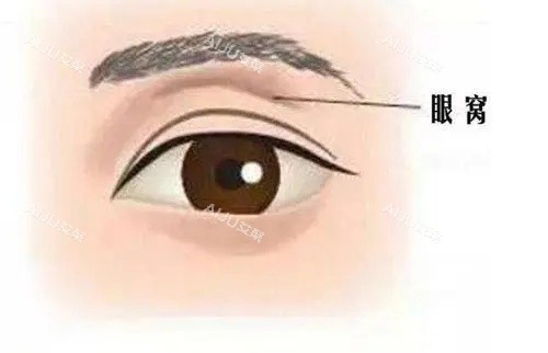 眼窝的示意图 眼窝的示意图