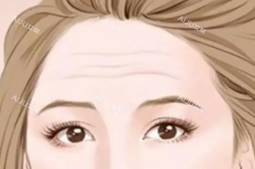 抬头纹卡通图 抬头纹卡通图