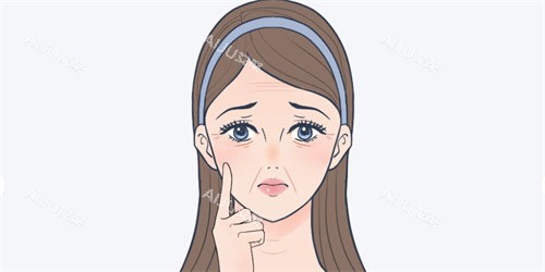 法令纹动画展示图 法令纹动画展示图