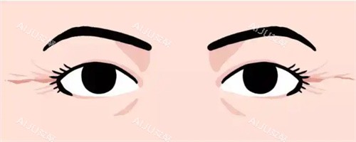 鱼尾纹卡通展示 鱼尾纹卡通展示