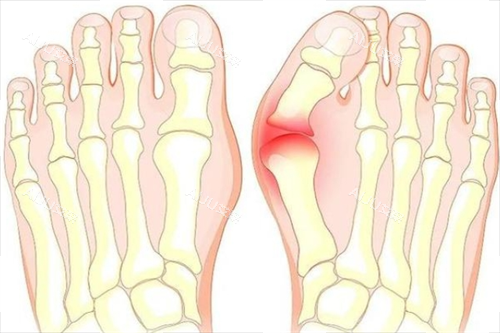 大脚骨脚步骨头透视图 大脚骨脚步骨头透视图