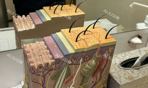 石家庄雅芳亚整形皮肤科模型展示 石家庄雅芳亚整形皮肤科模型展示