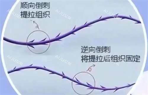 倒刺形状线材样子图解