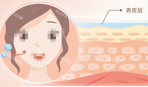 玻尿酸面部注射动画以及皮肤表面 玻尿酸面部注射动画以及皮肤表面