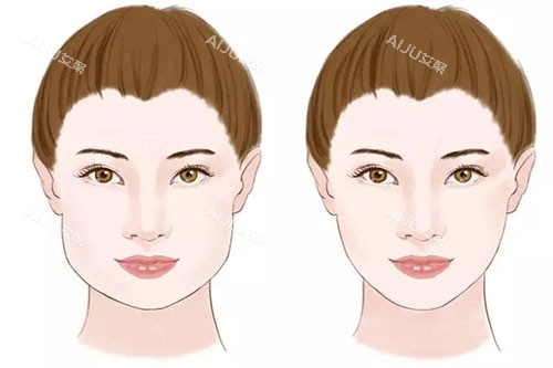 瘦脸卡通对比图
