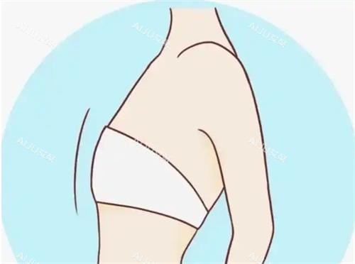 平胸动画展示图 平胸动画展示图