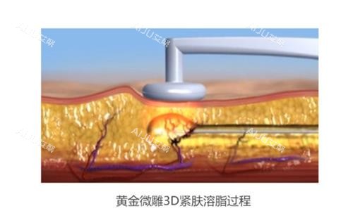 黄金微雕示意图 黄金微雕示意图