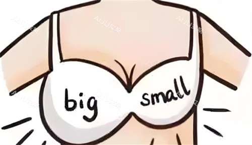 乳房大小对比 乳房大小对比