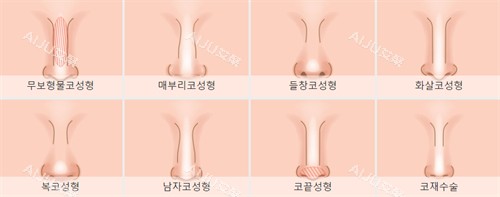 不同需要进行鼻整形的鼻子 不同需要进行鼻整形的鼻子