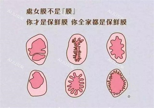 处女膜形状动画演示图 处女膜形状动画演示图