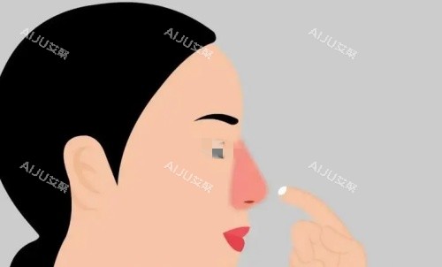 酒糟鼻侧面示意图 酒糟鼻侧面示意图