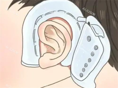 耳朵矫正器的形状 耳朵矫正器的形状