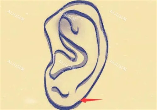 正常的耳垂形状 正常的耳垂形状