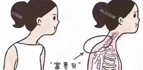 脖子富贵包卡通图展示照片 脖子富贵包卡通图展示照片