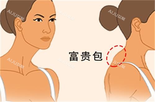 富贵包所在位置图解 富贵包所在位置图解