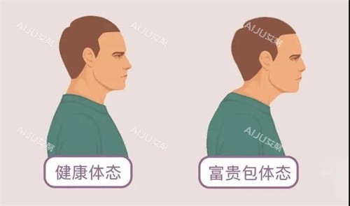 富贵包和健康体态对比动画图 富贵包和健康体态对比动画图