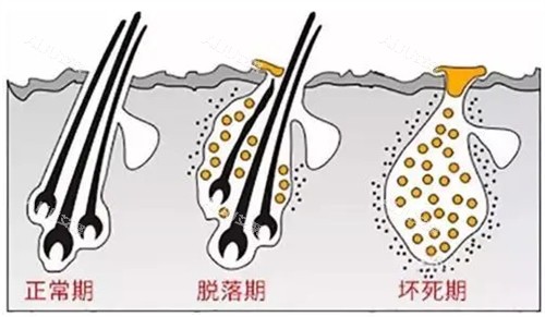 头发生长周期图解 头发生长周期图解