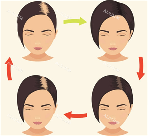 脱发周期素材 脱发周期素材